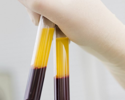 Is PRP a kind of stem cell therapy?