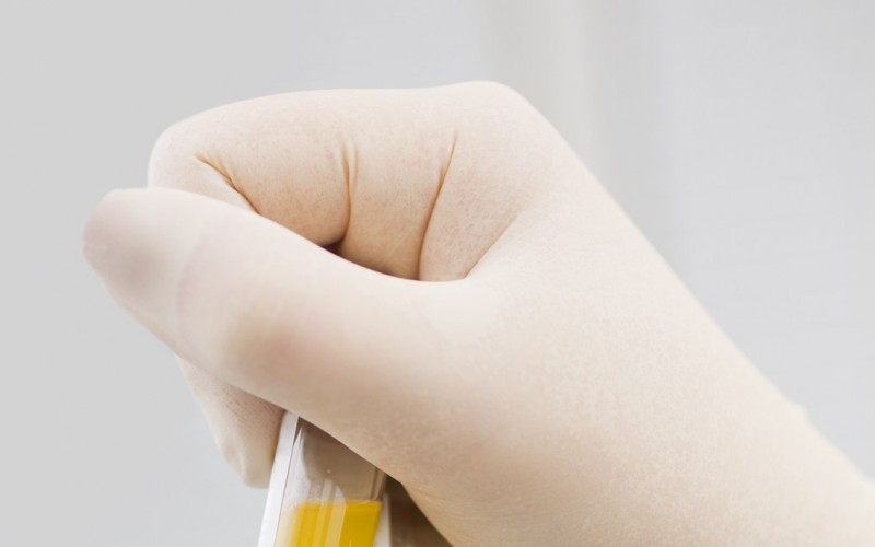 Is PRP a kind of stem cell therapy?